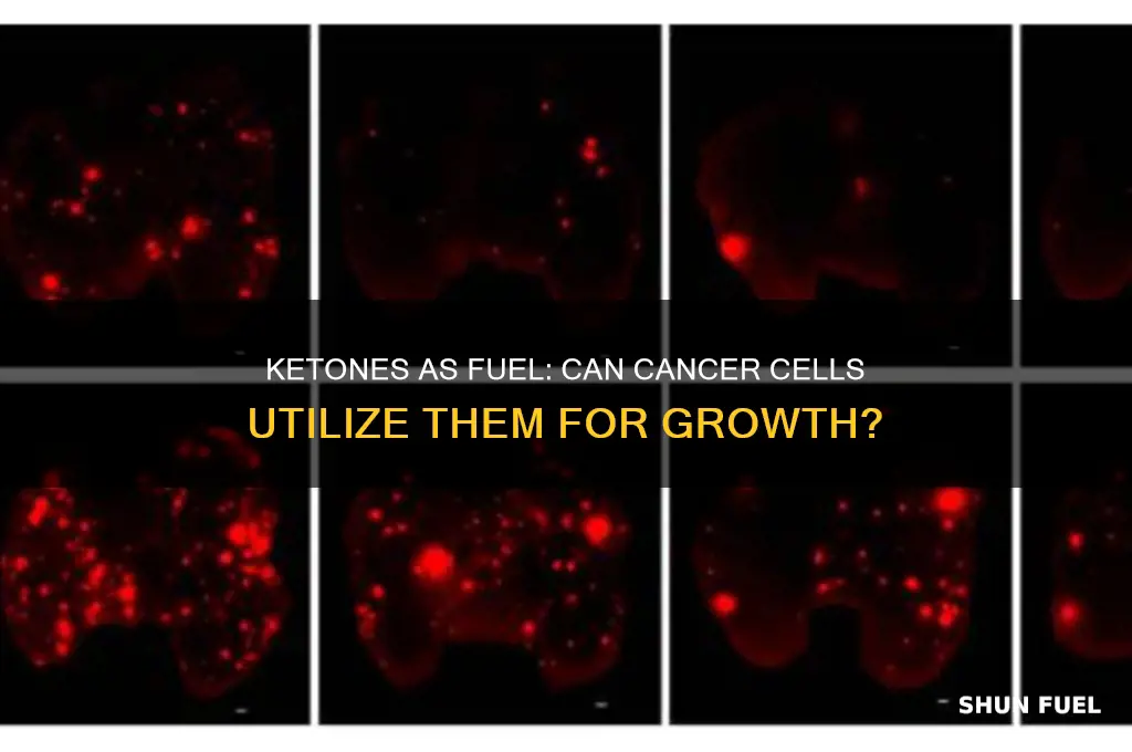 can cancer cells use ketones as fuel