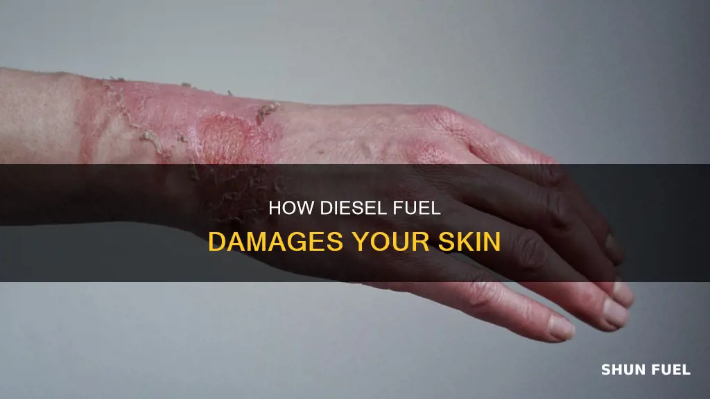 can diesel fuel burn your skin
