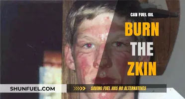 Can Fuel Oil Burn Skin? Understanding Risks and Safety Measures
