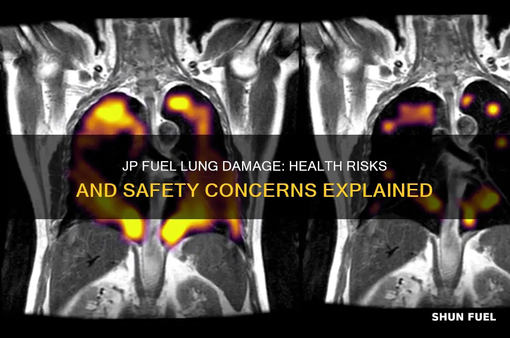can jp fuel damage your lungs
