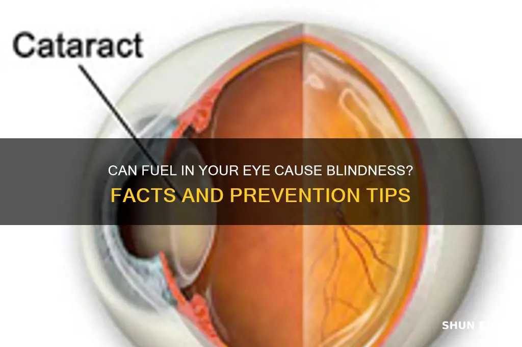 can you go blind from getting fuel in tour eye