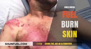 How Diesel Fuel Affects Your Skin