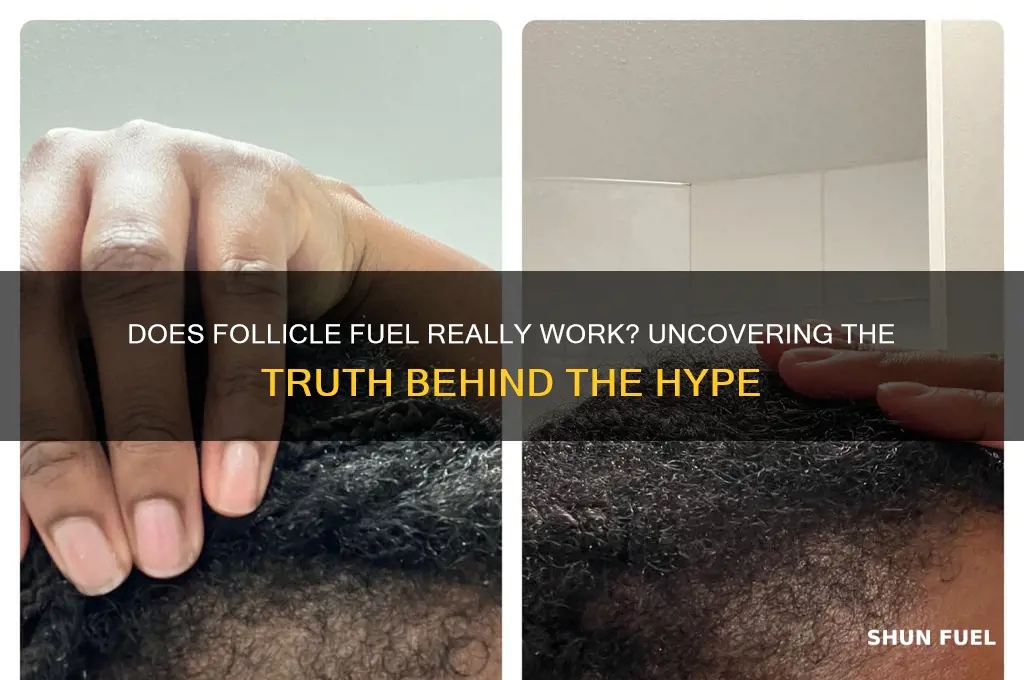 does follicle fuel really work
