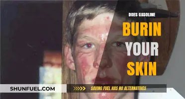 The Surprising Truth About Gasoline and Skin Contact