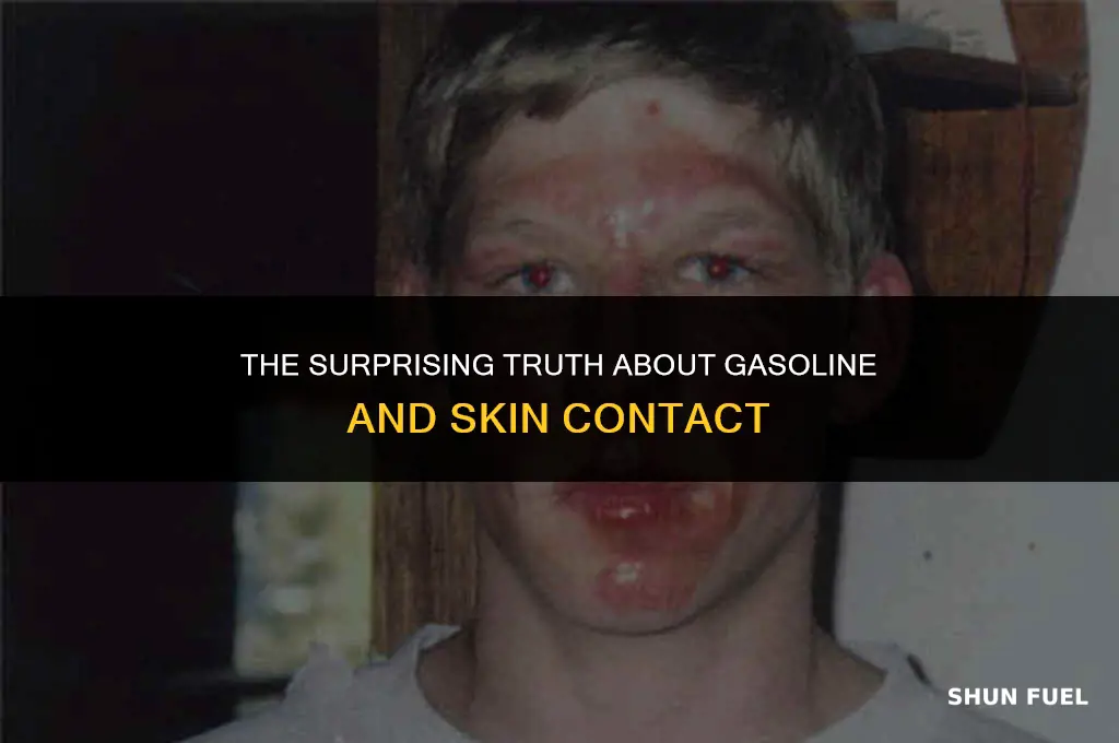 does gasoline burin your skin