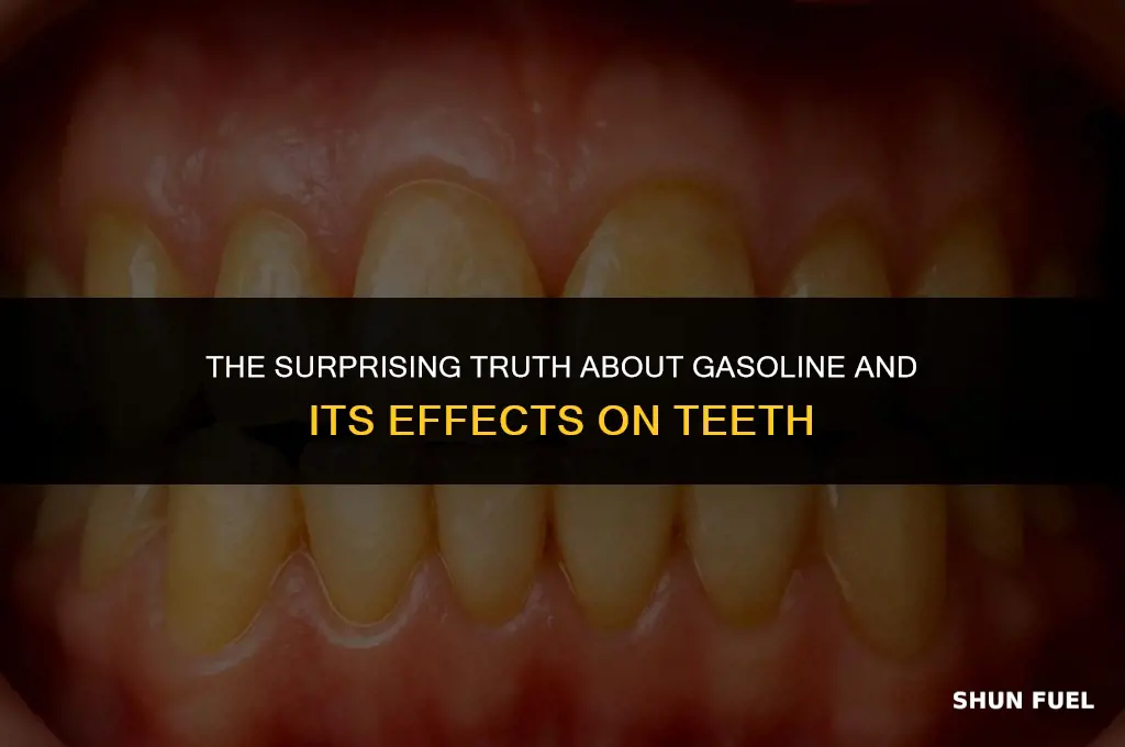 does gasoline decay teeth