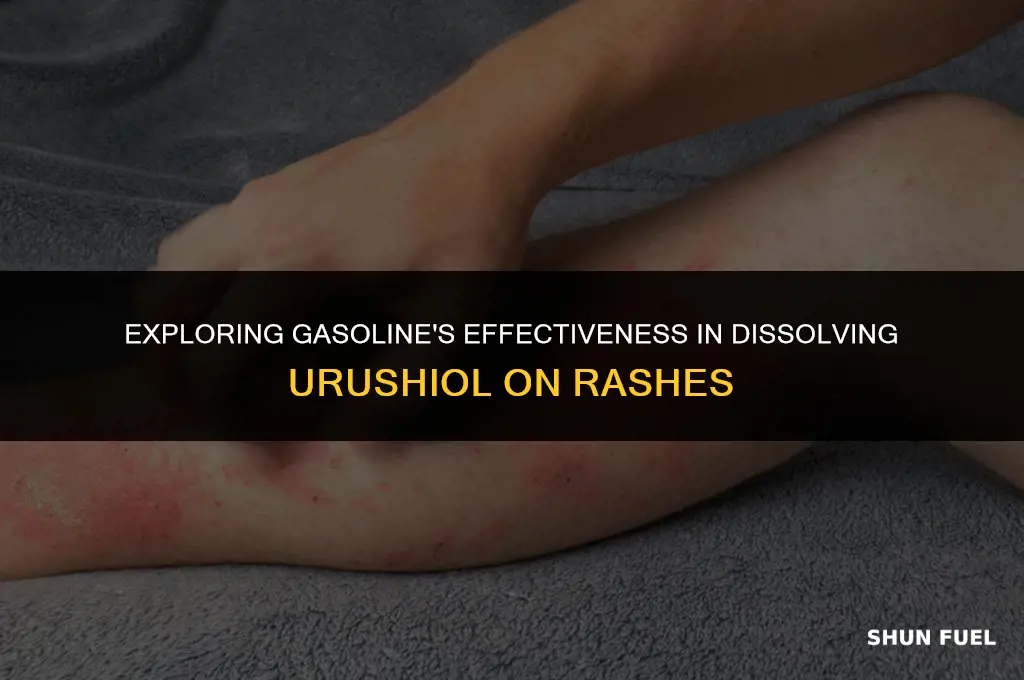 does gasoline dissolve urushiol on a rash