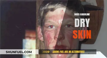 Does Gasoline Dry Skin? Understanding the Effects of Fuel on Your Hands