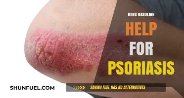 Exploring the Myth: Gasoline as a Psoriasis Remedy