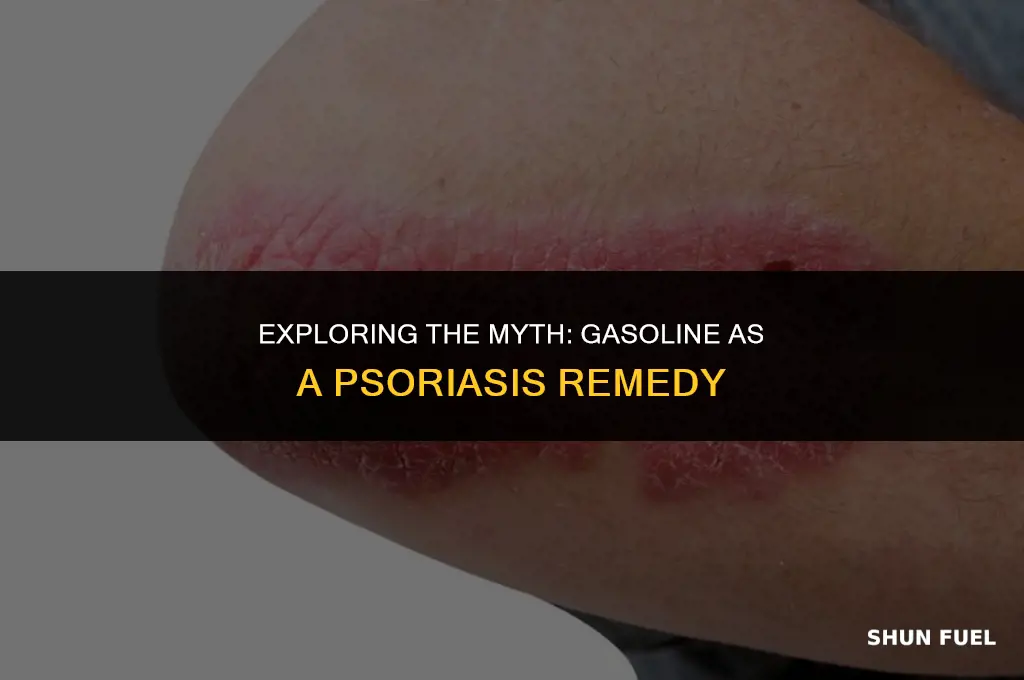 does gasoline help for psoriasis