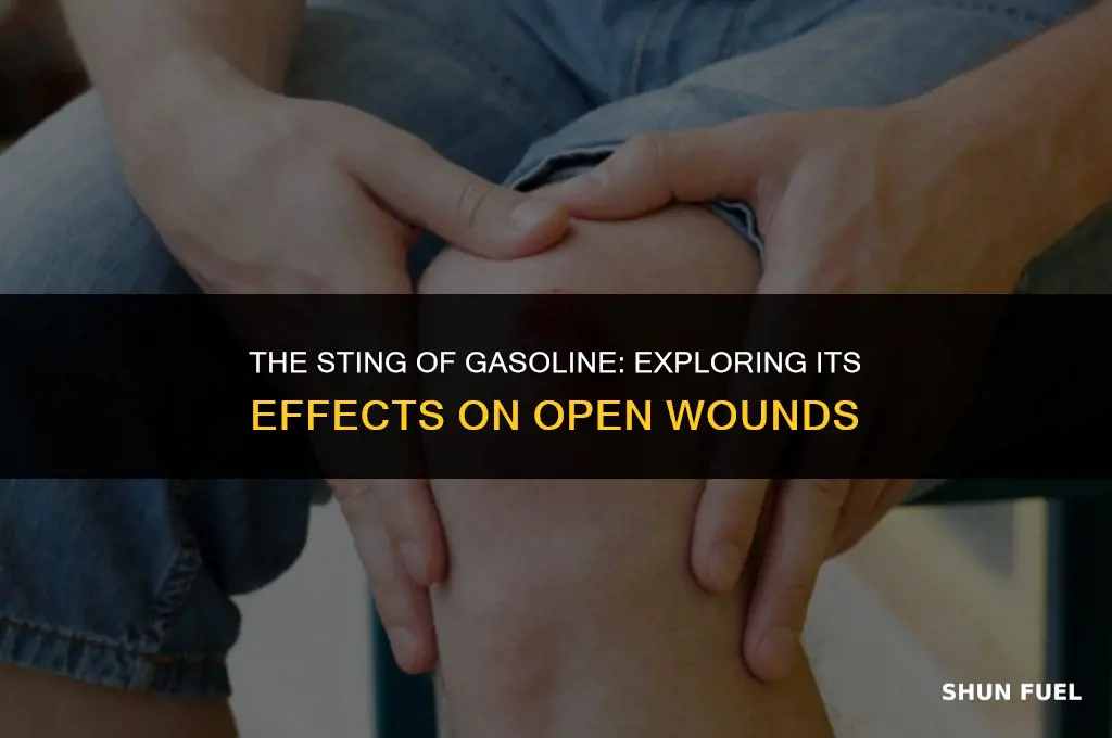 does gasoline hurt on open wounds