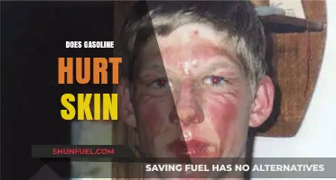 Does Gasoline Hurt Skin? Understanding the Effects and Safety Measures