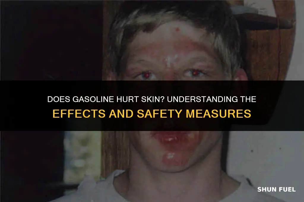 does gasoline hurt skin