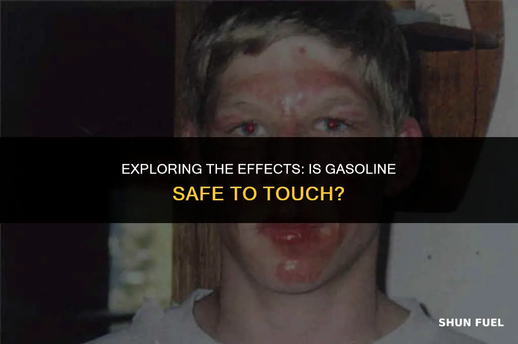 does gasoline hurt to touch