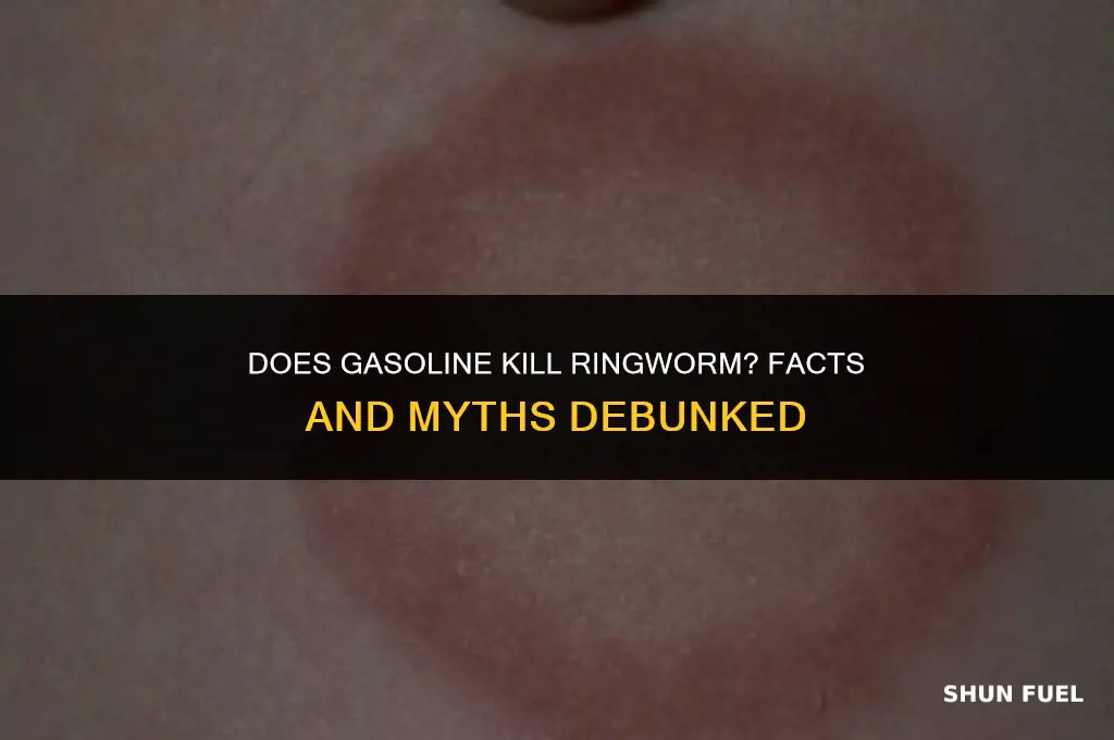 does gasoline kill ringworm