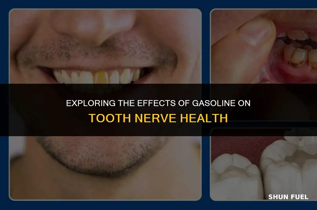 does gasoline kill tooth nerve