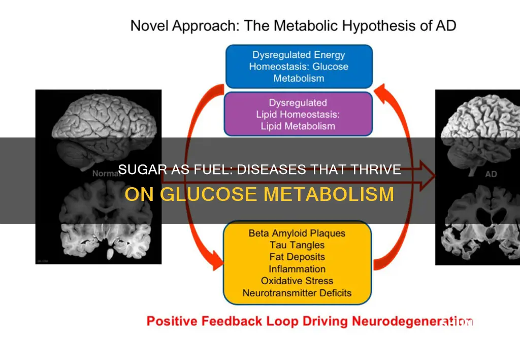 what diseases make sugar fuel