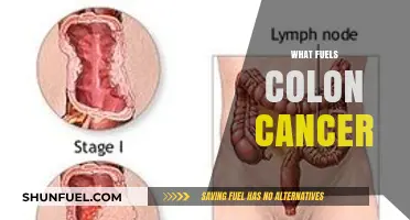 Unraveling the Key Factors That Fuel Colon Cancer Growth