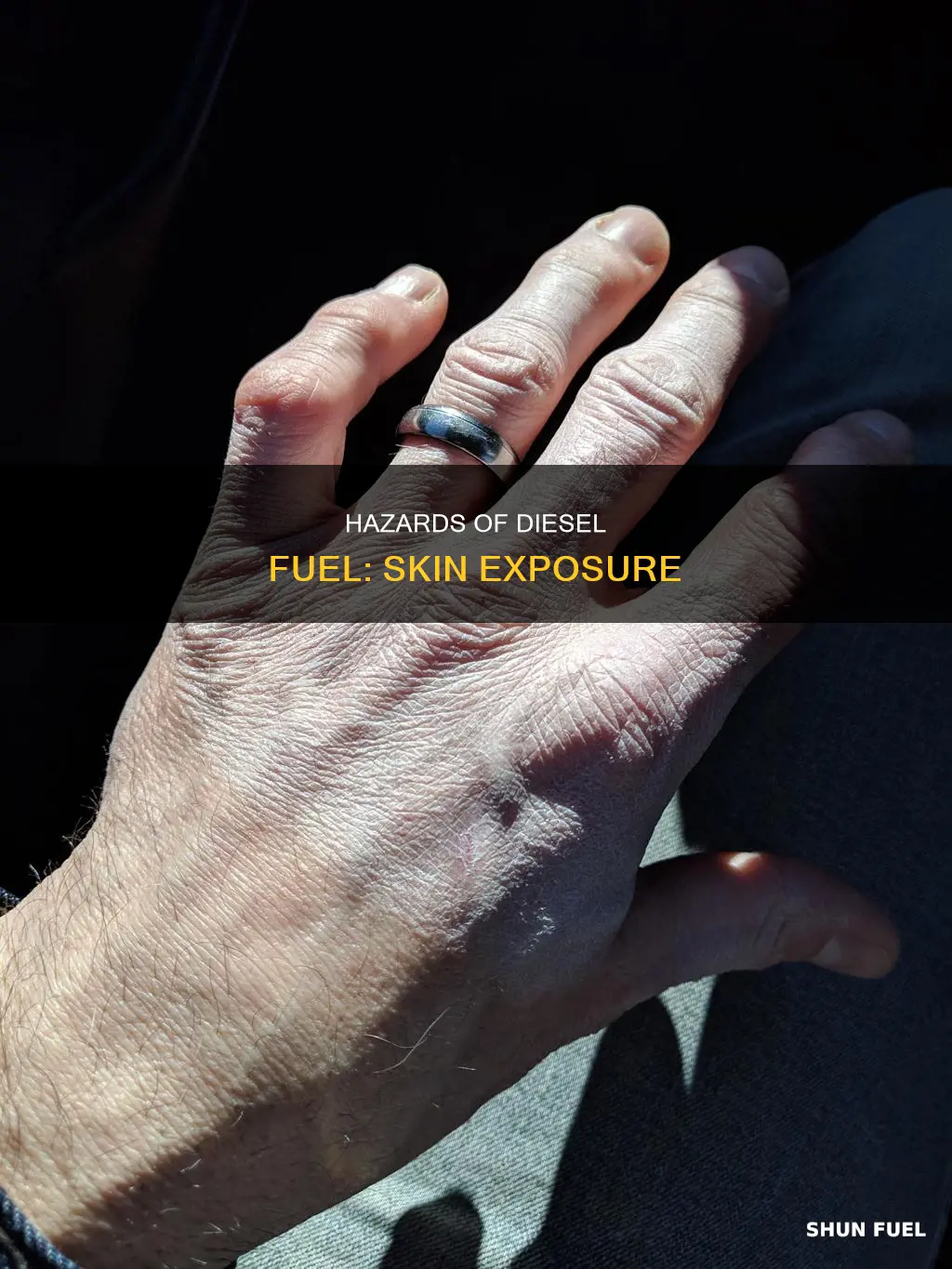 what happens when diesel fuel is exposed to the skin